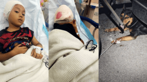 Kanak-Kanak 6 Tahun Digigit Anjing Kini Stabil, Polis Siasat Pemilik